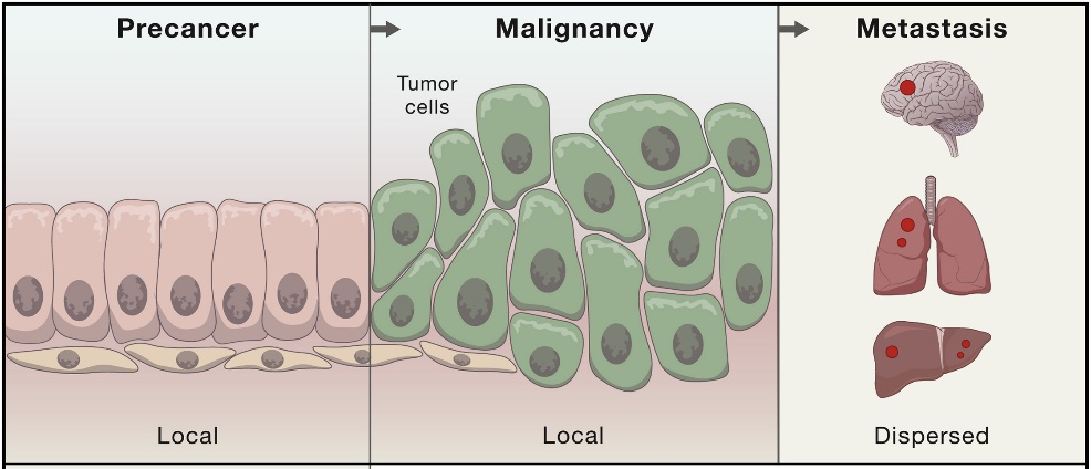 癌细胞的生长和转移示意图