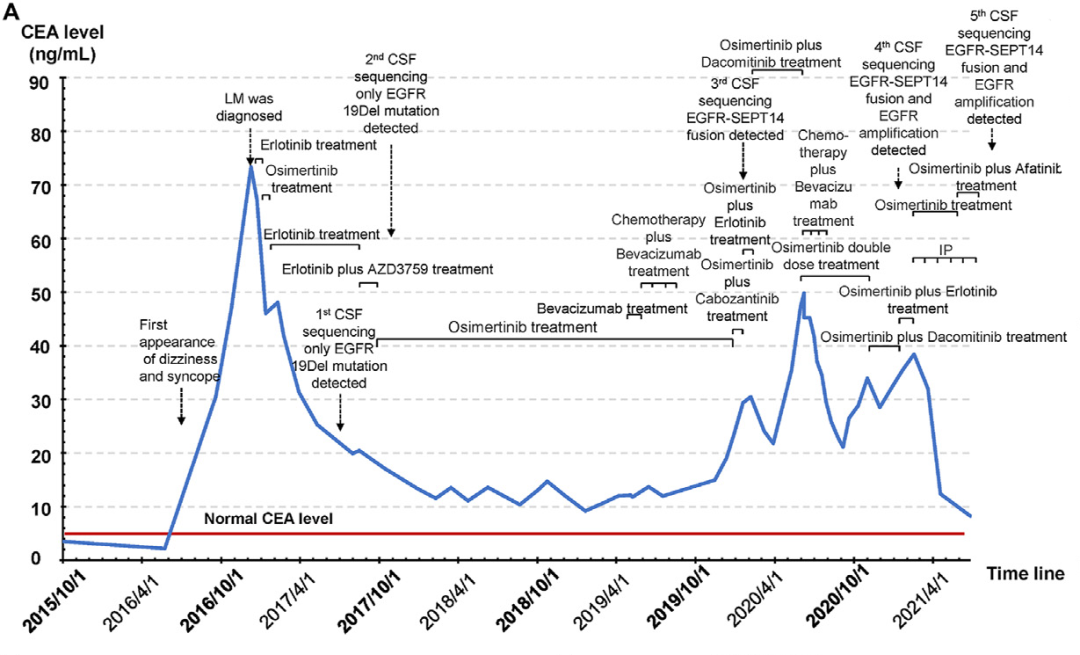 肿瘤患者治疗过程及对应的CEA水平和基因变异丰度变化情况