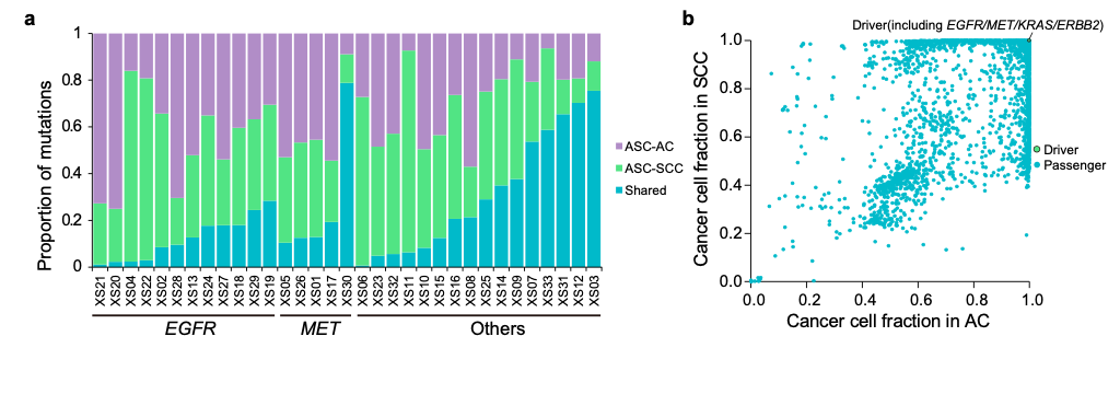 腺鳞癌显微切割腺癌和鳞细胞癌成分的基因谱11