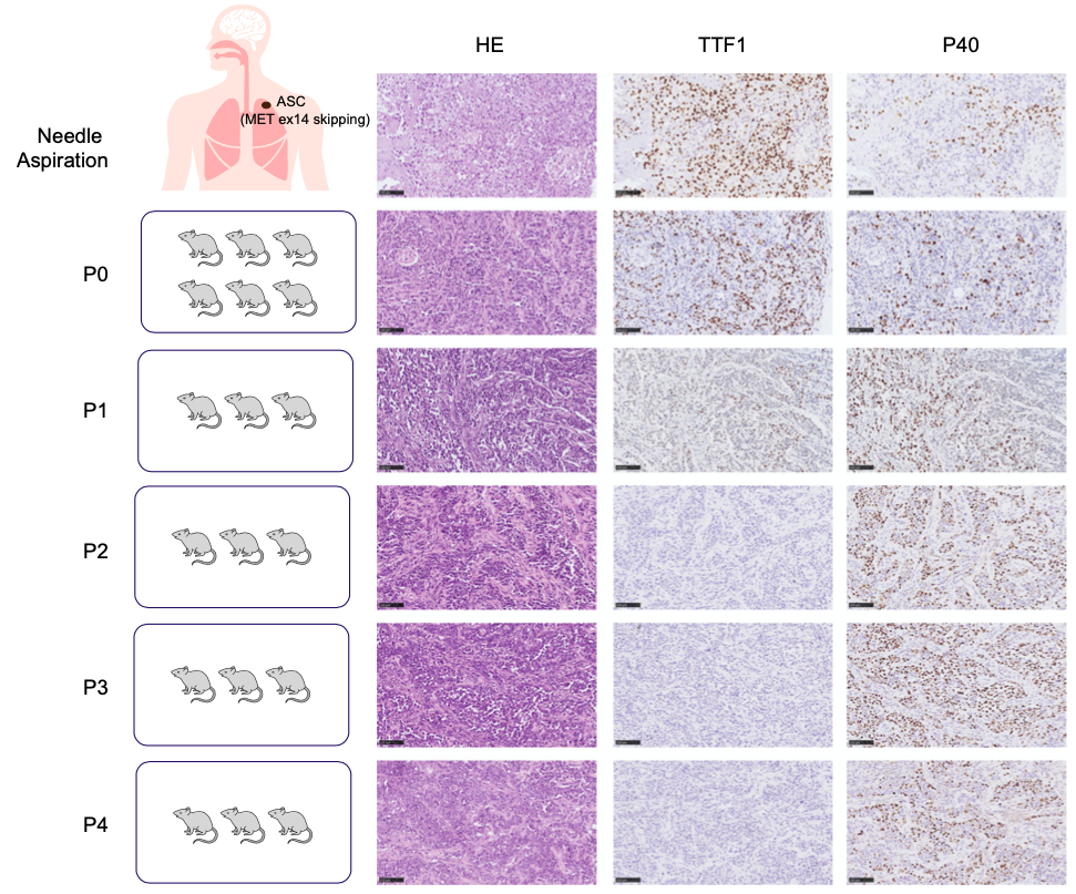 肺腺鳞癌人源性组织异种移植模型