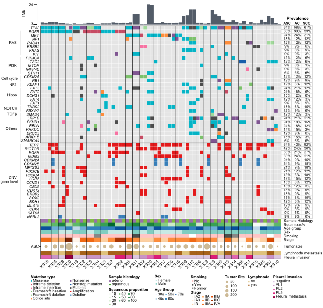 腺鳞癌显微切割腺癌和鳞细胞癌成分的基因谱