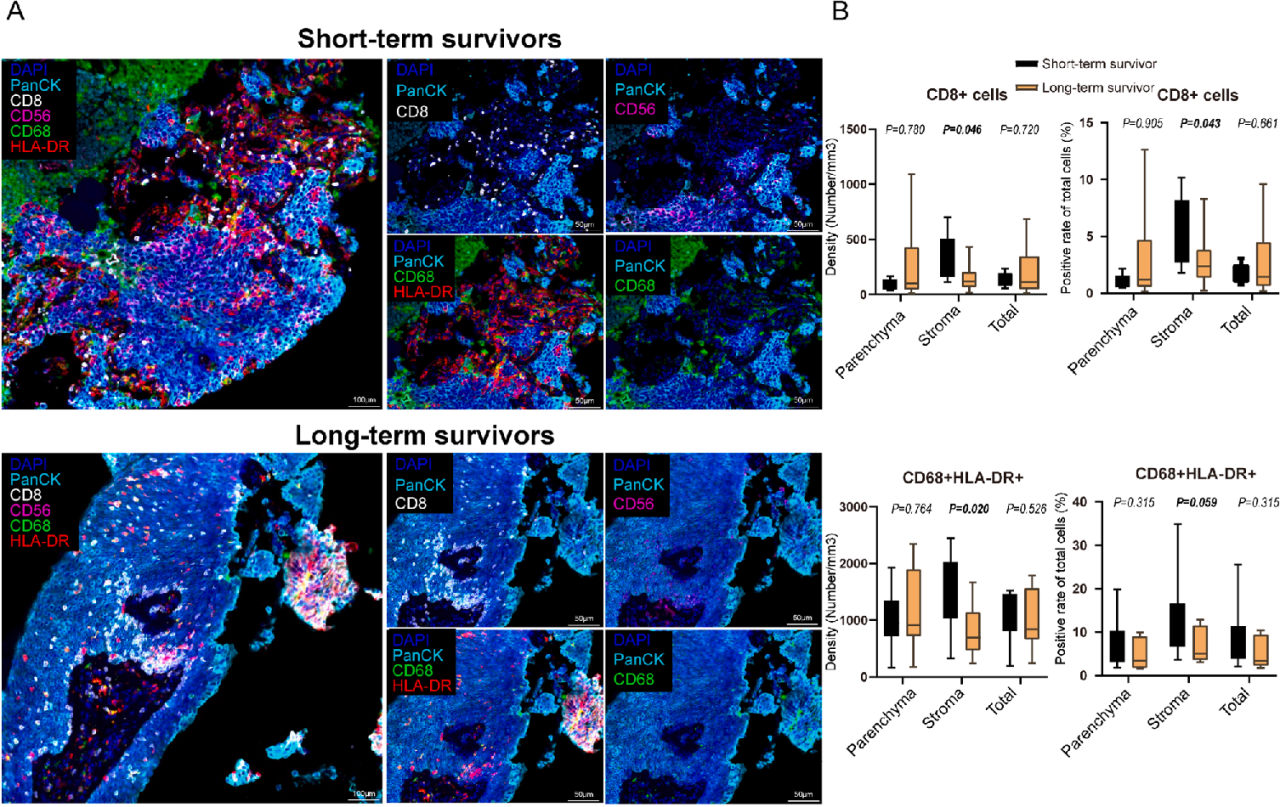多重免疫荧光的免疫细胞浸润与预后间的关系