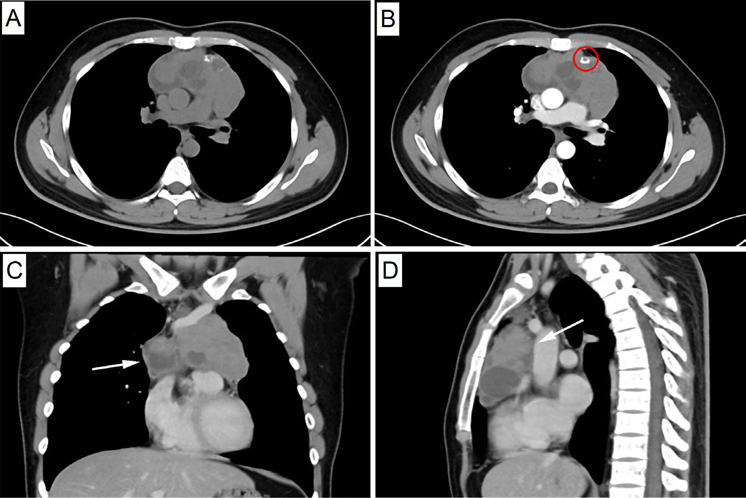 37000vip威尼斯基因肿瘤基因检测学术文章