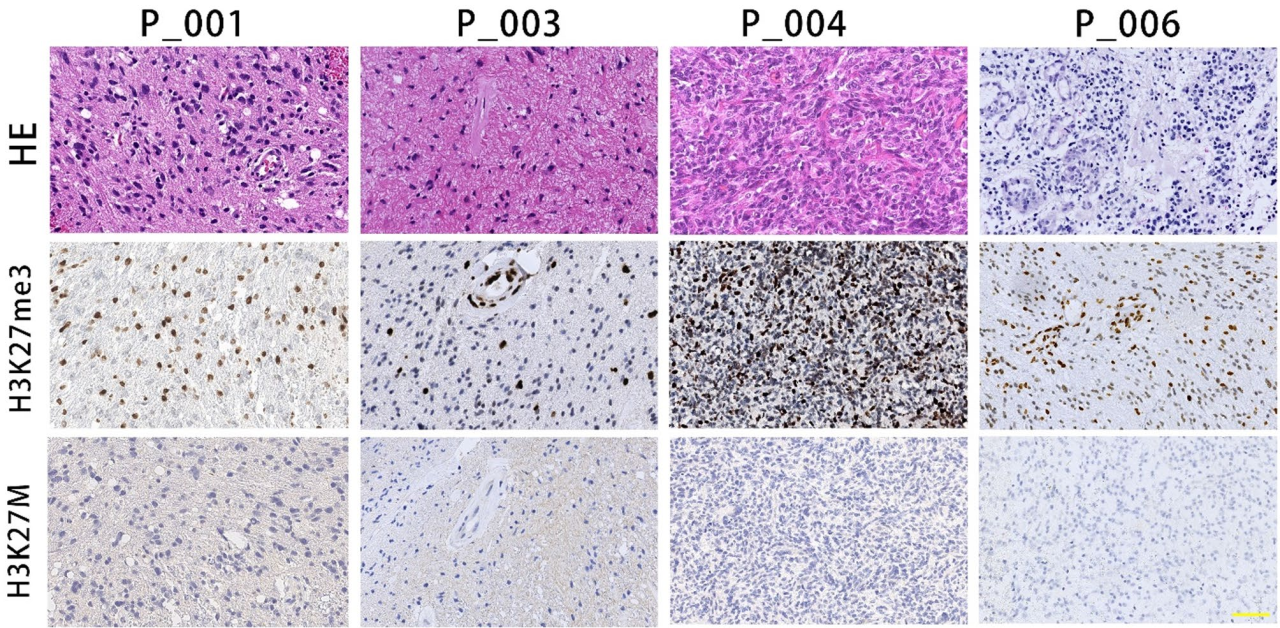 世和基因肿瘤基因检测