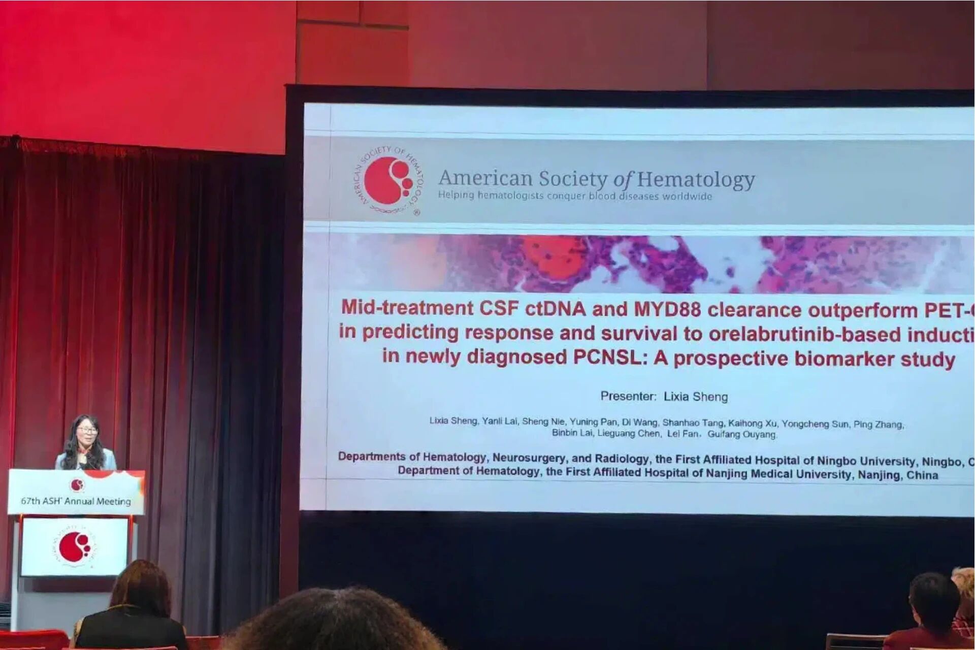 ASH口头报告：脑脊液ctDNA是原发中枢神经系统淋巴瘤更优疗效指标