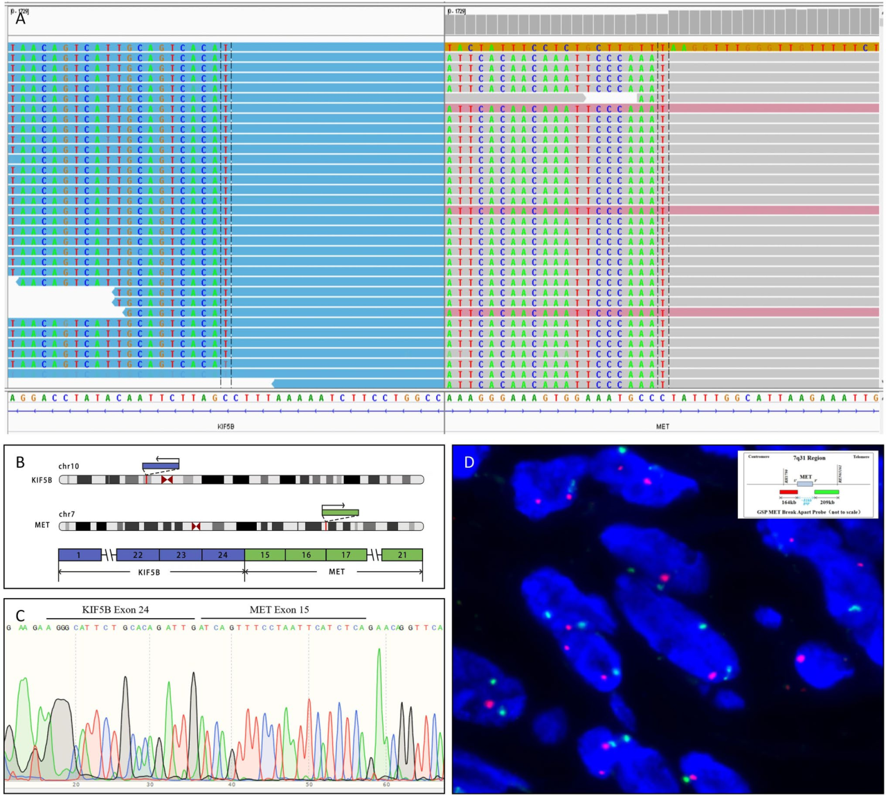 37000vip威尼斯基因肿瘤基因检测学术文章