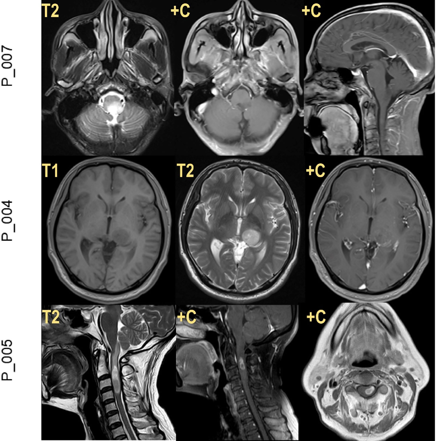 世和基因肿瘤基因检测