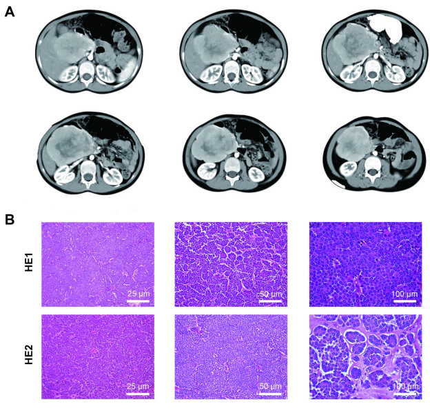 37000vip威尼斯肿瘤基因检测学术文章