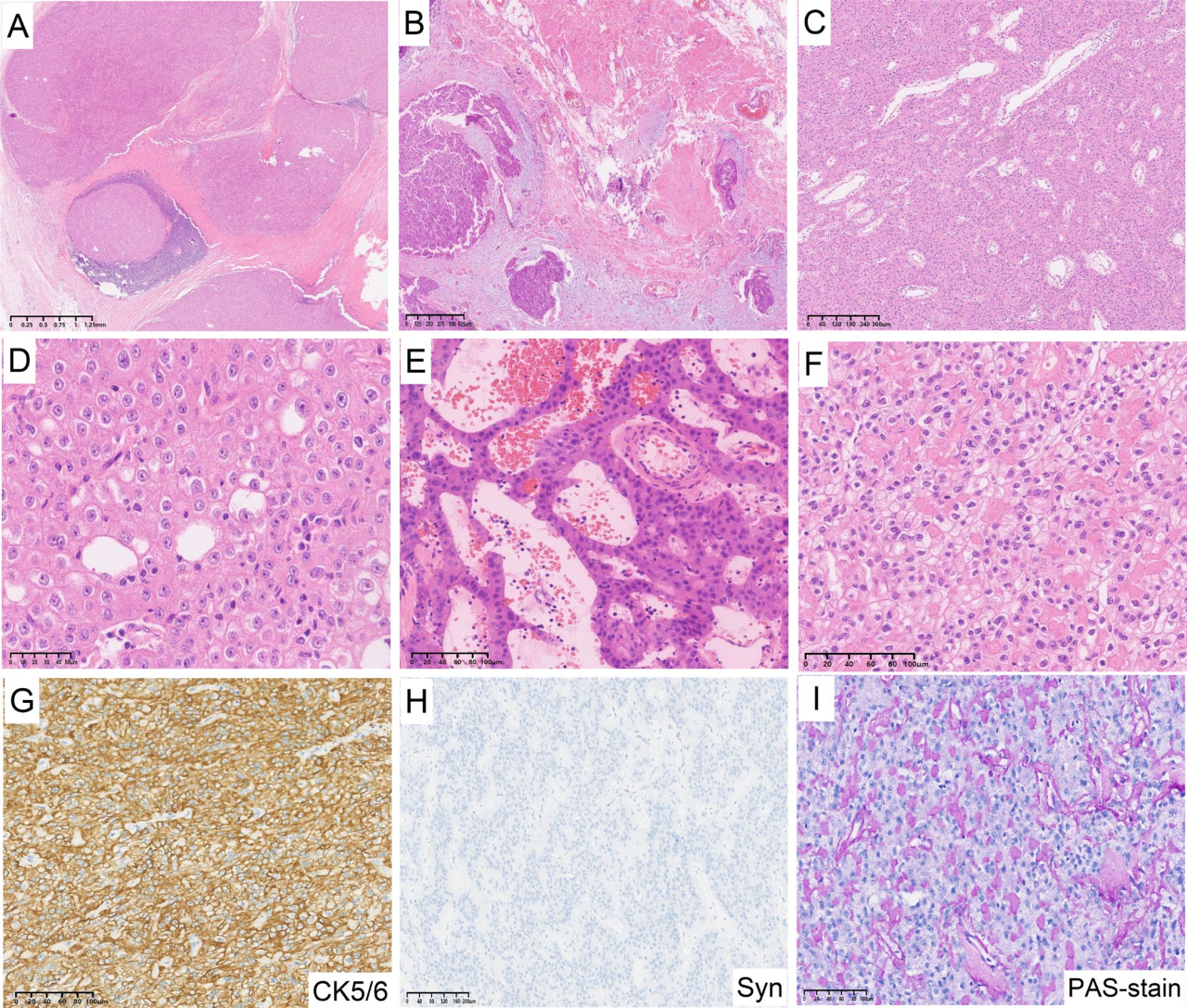 37000vip威尼斯基因肿瘤基因检测学术文章