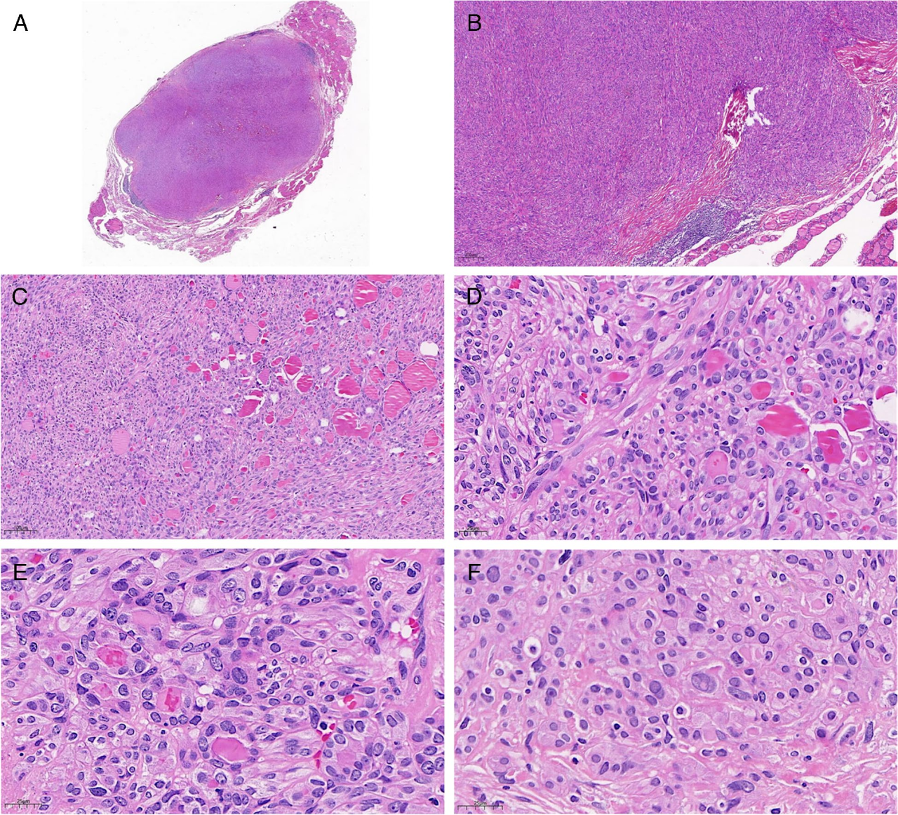 37000vip威尼斯基因肿瘤基因检测学术文章