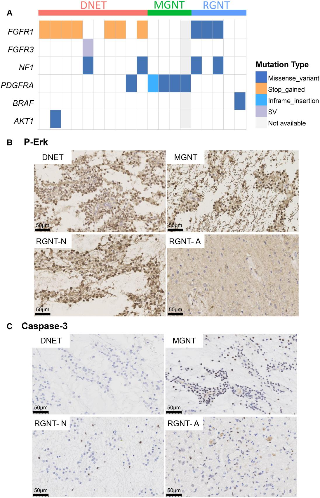 DNET、MGNT和RGNT的基因突变图谱及免疫组化染色结果